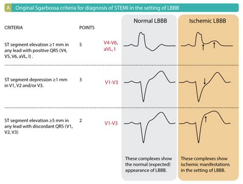 lv block|lbbb full form in medical.